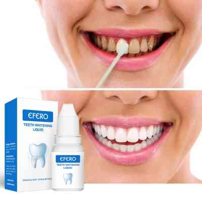 Sérum Éclaircissant pour les Dents – Essence Liquide Blanchissante Professionnelle ACDS0006 Accueil 8 000 FCFA Sérum Éclaircissant pour les Dents – Essence Liquide Blanchissante Professionnelle ACDS0006 Accueil 8 000 FCFA